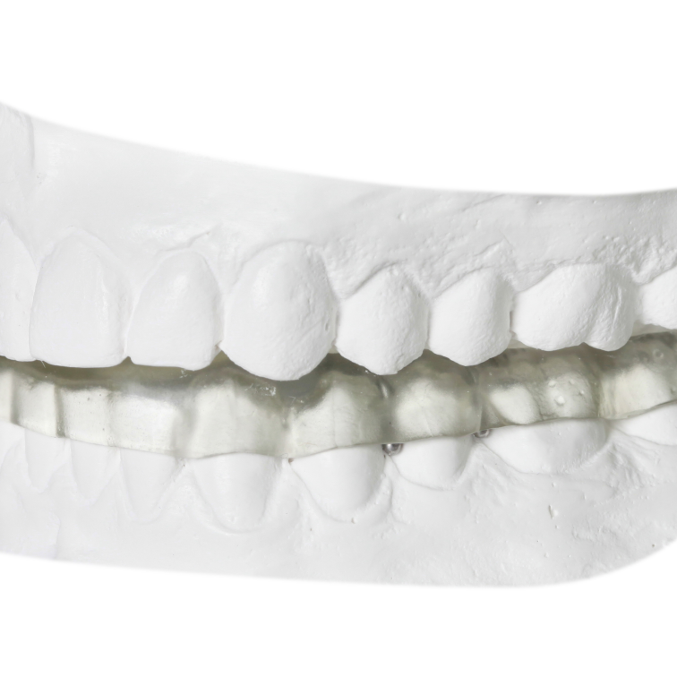 Orthodontics and TMJ & Sleep Appliances Gergen's Orthodontic Lab