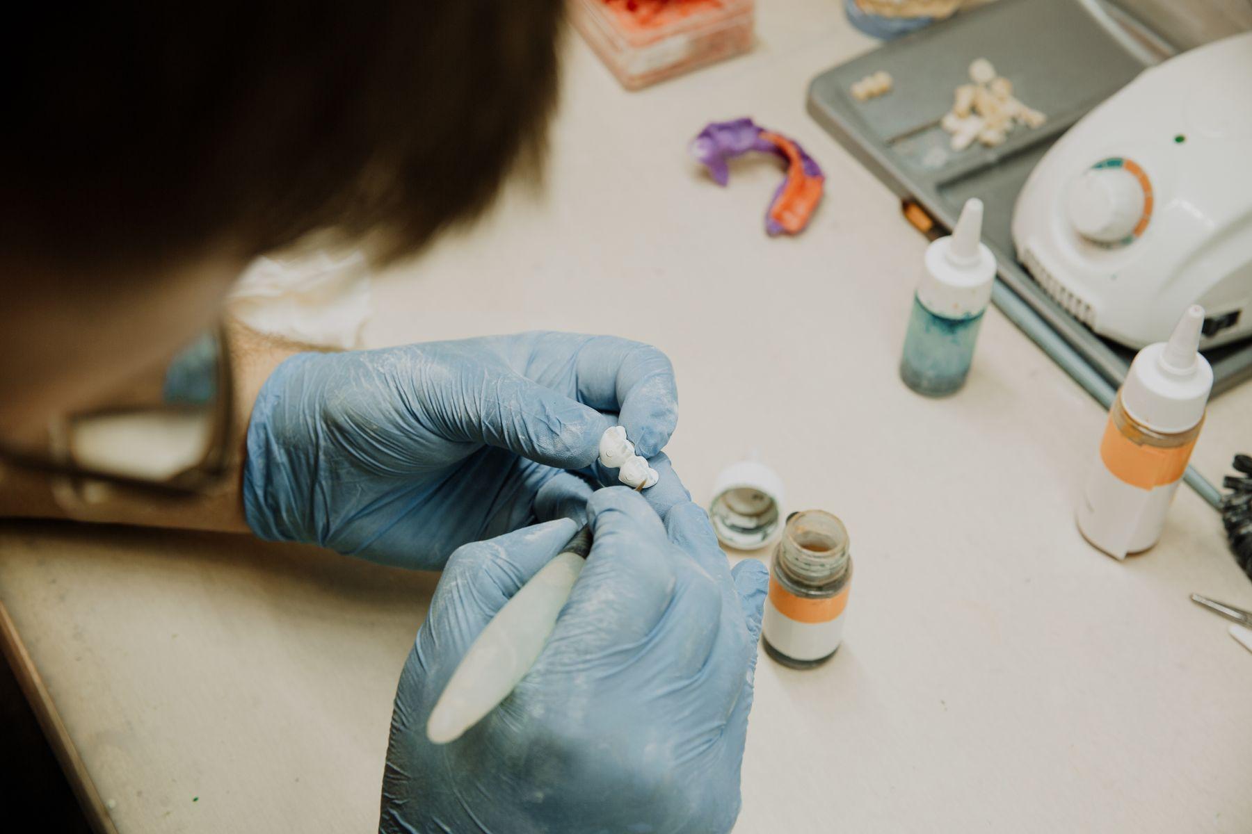 A dental technician in gloves finishing a small appliance component at the laboratory bench