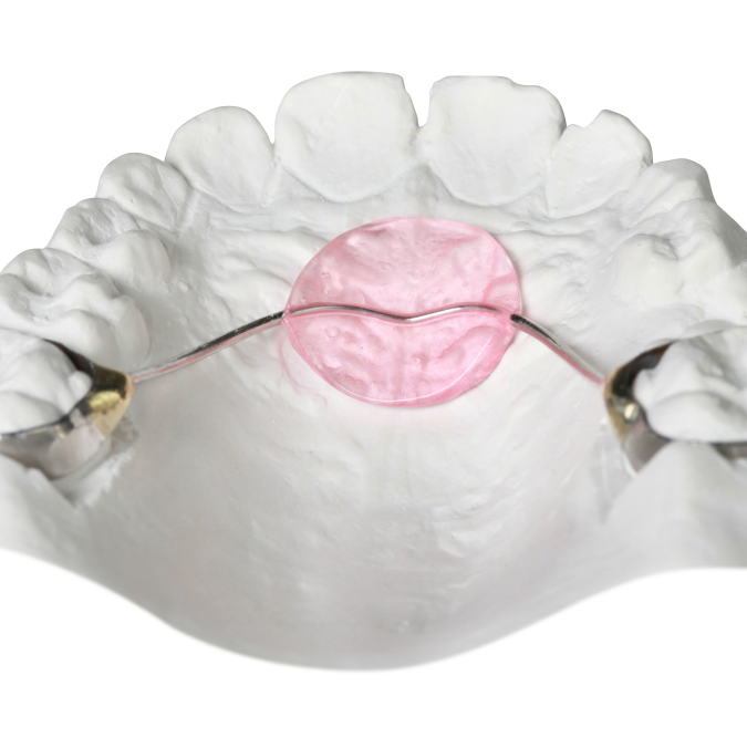 Orthodontics Gergen's Orthodontic Lab