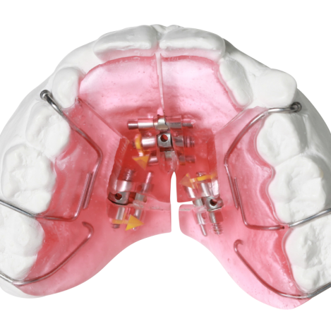 Orthodontics and TMJ & Sleep Appliances – Gergen's Orthodontic Lab