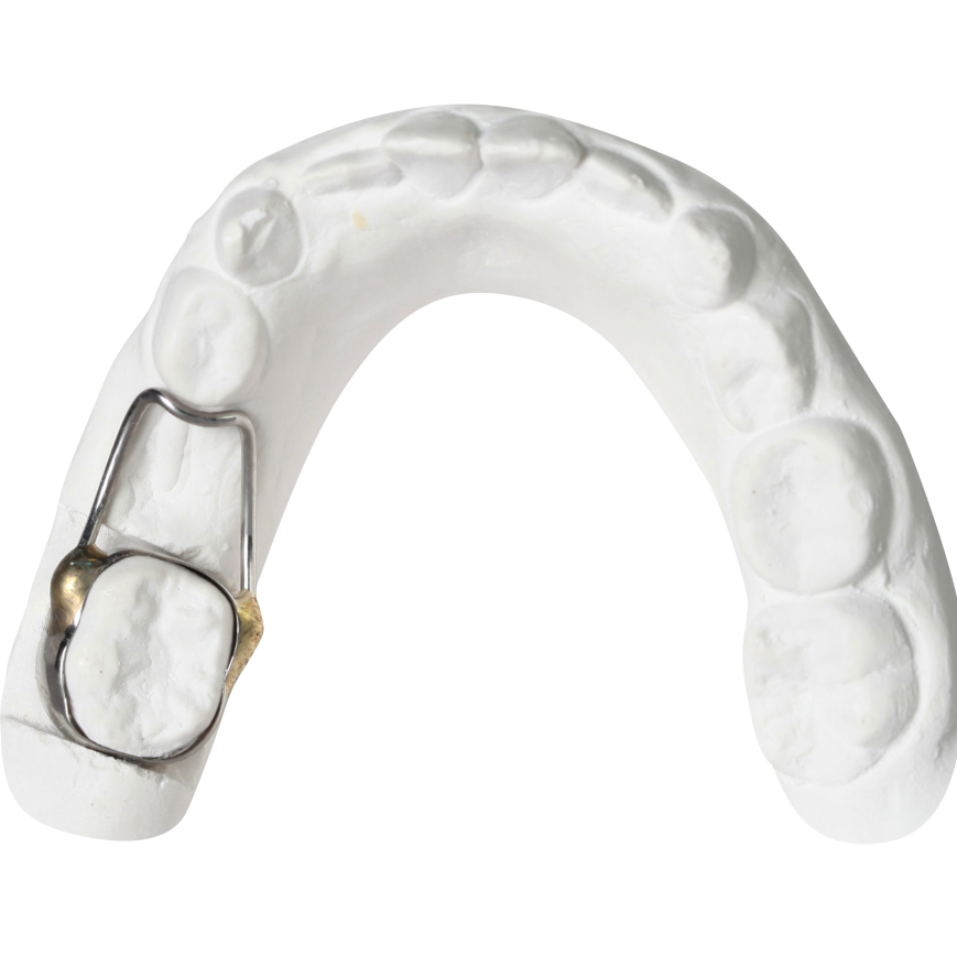 Orthodontics Gergen's Orthodontic Lab