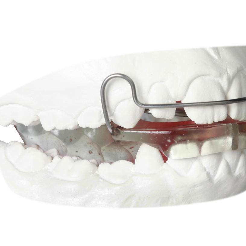 Orthodontics Gergen's Orthodontic Lab